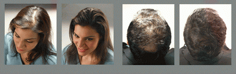 fryzury-dla-bardzo-rzadkich-wosw-19_2 Fryzury dla bardzo rzadkich włosów